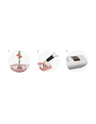 NSK Osseo 100+