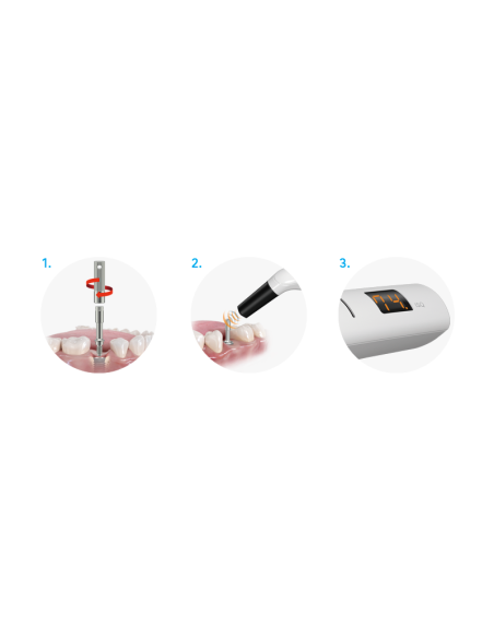 NSK Osseo 100+