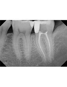 DEXIS Titanium 2