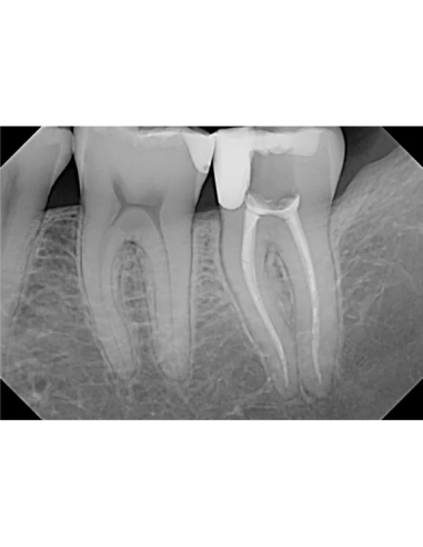 DEXIS Titanium